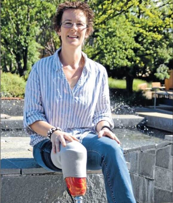 Stephanie Lloyd will receive the breakthrough surgery to end the constant pain she experiences as a result of the amputation of her leg 25 years ago. Money for the surgery was raised by Armidale Dumaresq Lions Club.