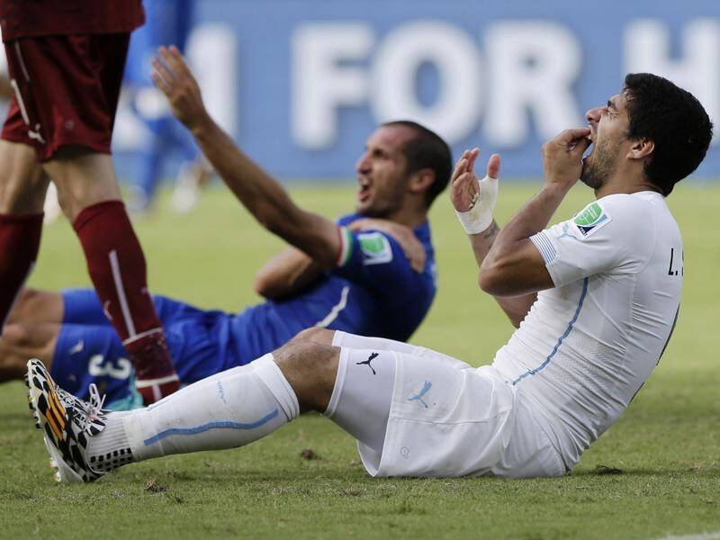 Luis Suarez holds his teeth after biting Italy's Giorgio Chiellini's shoulder in the 2014 World Cup.