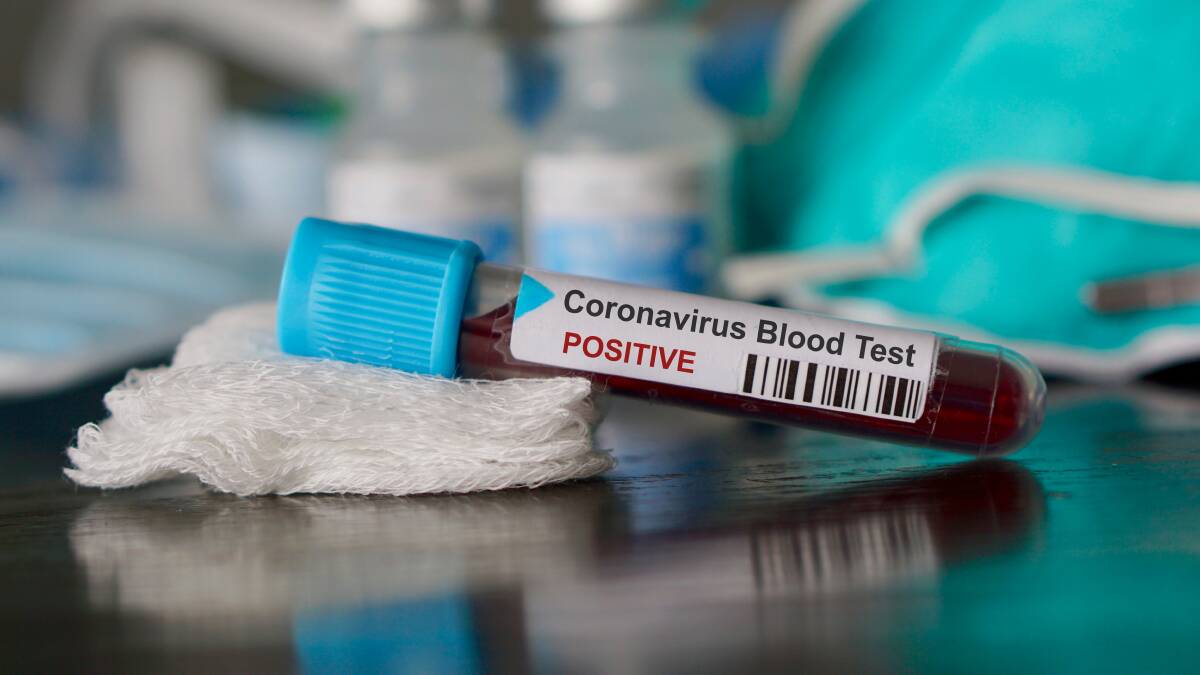 Why we need more information about coronavirus cases